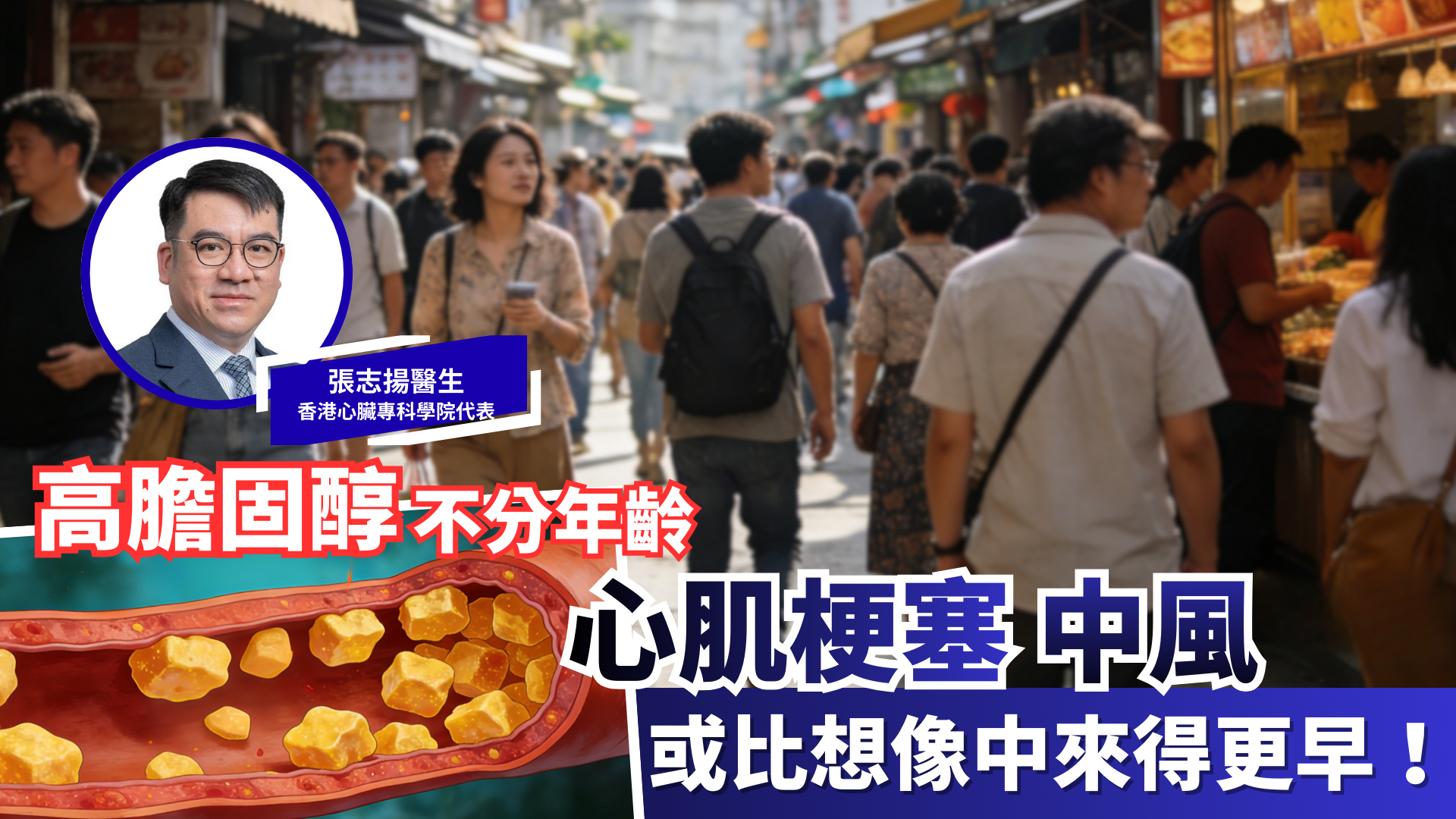 高膽固醇無分年齡 | 張志揚醫生